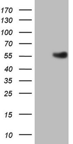 ESRRB Monoclonal Antibody (OTI1E6), TrueMAB , OriGene 100 &mu;L | Buy Online | Origene Technologies | Fisher Scientific