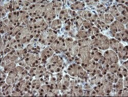 ESRRG Monoclonal Antibody (OTI6G1), TrueMAB , OriGene 30 &mu;L; Unconjugated:Antibodies,
