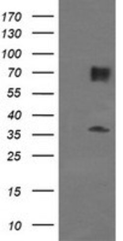 ESRRG Mouse anti-Human, Clone: OTI5D7, lyophilized, TrueMAB 100 &mu;g;