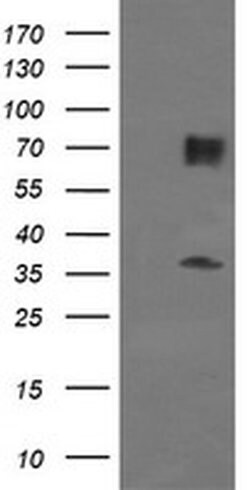 ESRRG Monoclonal Antibody (OTI5D7), TrueMAB , OriGene:Antibodies:Primary