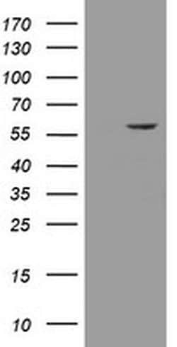 ESRRG Monoclonal Antibody (OTI5G8), TrueMAB , OriGene 30 &mu;L; Unconjugated:Antibodies,