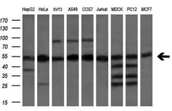 ETF1 Mouse anti-Human, Clone: OTI2E3, lyophilized, TrueMAB 100 &mu;g; Unconjugated:Antibodies,