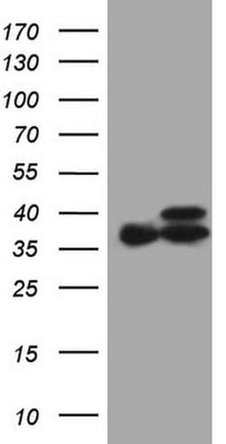 ETFA Monoclonal Antibody (OTI5C4), TrueMAB , OriGene 100 &mu;L; Unconjugated:Antibodies,