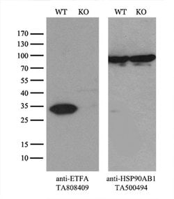 ETFA Monoclonal Antibody (OTI5C4), TrueMAB , OriGene:Antibodies:Primary