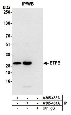 ETFB Rabbit anti-Human, Mouse, Polyclonal, Bethyl Laboratories 100 &mu;L;