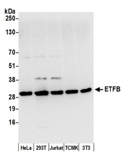 ETFB Rabbit anti-Human, Mouse, Polyclonal, Bethyl Laboratories 100 &mu;L;