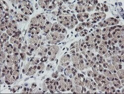 ETS2 Mouse anti-Human, Clone: OTI1H4, lyophilized, TrueMAB 100 &mu;g; Unconjugated:Antibodies,