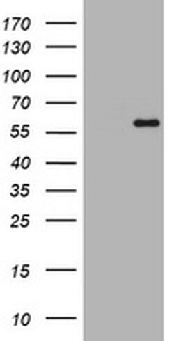 ETS2 Monoclonal Antibody (OTI3E10), TrueMAB , OriGene:Antibodies:Primary