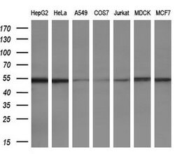 ETS2 Mouse anti-Human, Clone: OTI1H4, lyophilized, TrueMAB 100 &mu;g; Unconjugated:Antibodies,