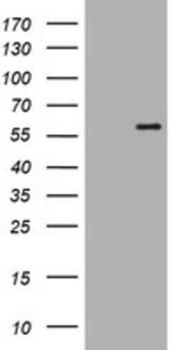 ETS2 Mouse anti-Human, Clone: OTI3B9, lyophilized, TrueMAB 100 &mu;g; Unconjugated:Antibodies,