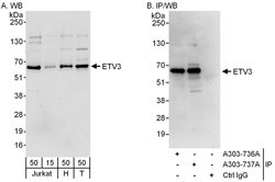 ETV3 Rabbit anti-Human, Polyclonal, Bethyl Laboratories 100 &mu;L; Unconjugated:Antibodies,