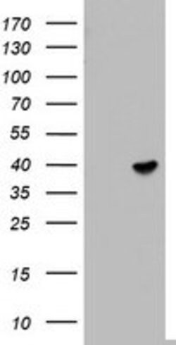 ETV7 Mouse anti-Human, Clone: OTI3B2, lyophilized, TrueMAB 100 &mu;g; Unconjugated:Antibodies,