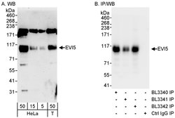 EVI5 Rabbit anti-Human, Polyclonal, Bethyl Laboratories 100 &mu;L; Unconjugated:Antibodies,