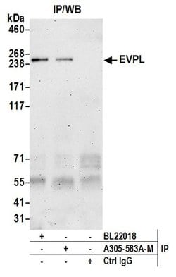 EVPL Polyclonal Antibody, Bethyl Laboratories 20 &mu;L | Buy Online | Bethyl Laboratories, Inc | Fisher Scientific