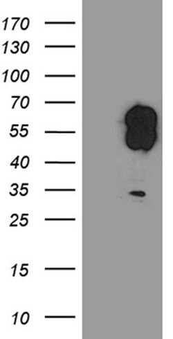 EVX1 Mouse anti-Human, Clone: OTI1F8, lyophilized, TrueMAB 100 &mu;g | Buy Online | OriGene | Fisher Scientific