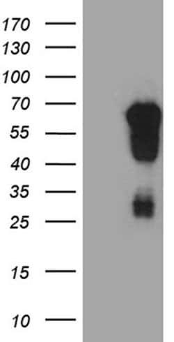 EVX1 Monoclonal Antibody (OTI1F4), TrueMAB , OriGene 30 &mu;L | Buy Online | Origene Technologies | Fisher Scientific