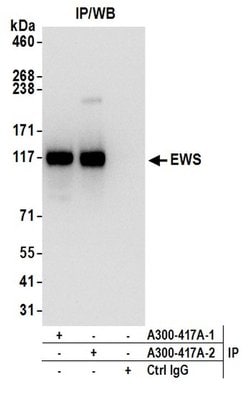 EWS Rabbit anti-Human, Polyclonal, Bethyl Laboratories 100 &mu;L; Unconjugated:Antibodies,
