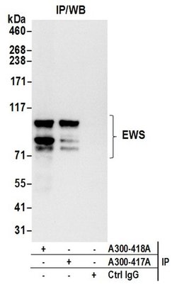 EWS Rabbit anti-Human, Polyclonal, Bethyl Laboratories 100 &mu;L; Unconjugated:Antibodies,
