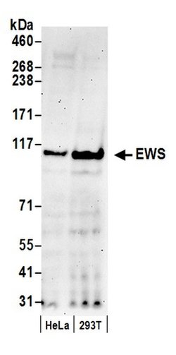 EWS Rabbit anti-Human, Polyclonal, Bethyl Laboratories 100 &mu;L; Unconjugated:Antibodies,