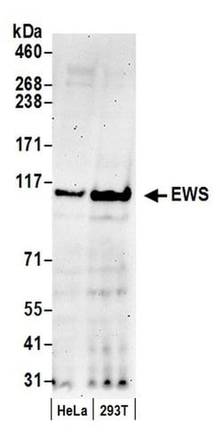 EWS Polyclonal Antibody, Bethyl Laboratories 20 &mu;L; Unconjugated:Antibodies,