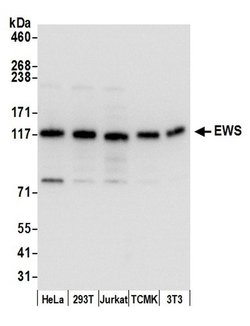 EWS Rabbit anti-Human, Polyclonal, Bethyl Laboratories 100 &mu;L; Unconjugated:Antibodies,