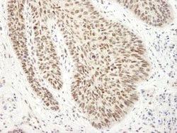 EWS Polyclonal Antibody, Bethyl Laboratories 10 &mu;L | Buy Online | Bethyl Laboratories, Inc | Fisher Scientific