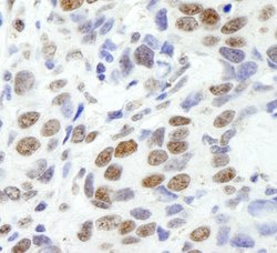 EWS Polyclonal Antibody, Bethyl Laboratories 10 &mu;L | Buy Online | Bethyl Laboratories, Inc | Fisher Scientific