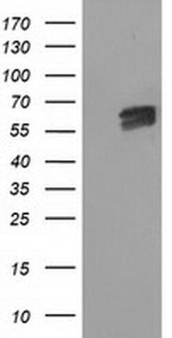 EXD1 Monoclonal Antibody (OTI4D7), TrueMAB , OriGene 100 &mu;L; Unconjugated:Antibodies,