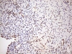 EXOSC1 Mouse anti-Human, Clone: OTI4B7, lyophilized, TrueMAB 100 &mu;g;