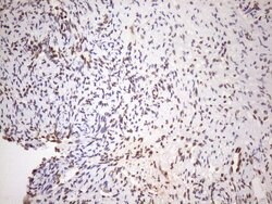 EXOSC1 Monoclonal Antibody (OTI4B7), TrueMAB , OriGene 100 &mu;L; Unconjugated:Antibodies,