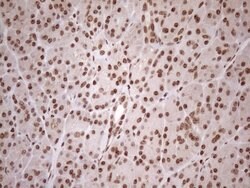 EXOSC1 Mouse anti-Human, Clone: OTI4B7, lyophilized, TrueMAB 100 &mu;g;