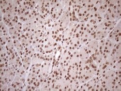 EXOSC1 Monoclonal Antibody (OTI4B7), TrueMAB , OriGene 100 &mu;L; Unconjugated:Antibodies,