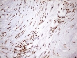 EXOSC1 Mouse anti-Human, Clone: OTI4B7, lyophilized, TrueMAB 100 &mu;g;