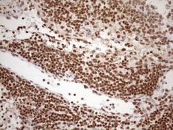 EXOSC1 Monoclonal Antibody (OTI4B7), TrueMAB , OriGene 100 &mu;L; Unconjugated:Antibodies,