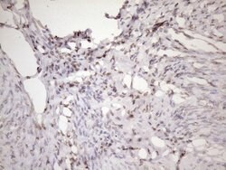 EXOSC1 Mouse anti-Human, Clone: OTI4B7, lyophilized, TrueMAB 100 &mu;g;