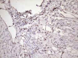 EXOSC1 Monoclonal Antibody (OTI4B7), TrueMAB , OriGene 100 &mu;L; Unconjugated:Antibodies,