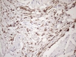 EXOSC1 Mouse anti-Human, Clone: OTI4B7, lyophilized, TrueMAB 100 &mu;g;
