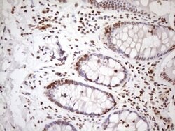 EXOSC1 Mouse anti-Human, Clone: OTI4B7, lyophilized, TrueMAB 100 &mu;g;