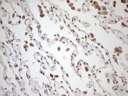 EXOSC1 Mouse anti-Human, Clone: OTI4B7, lyophilized, TrueMAB 100 &mu;g;