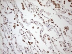 EXOSC1 Monoclonal Antibody (OTI4B7), TrueMAB , OriGene 100 &mu;L; Unconjugated:Antibodies,