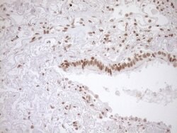 EXOSC1 Monoclonal Antibody (OTI1H9), TrueMAB , OriGene 100 &mu;L | Buy Online | OriGene | Fisher Scientific