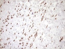 EXOSC1 Monoclonal Antibody (OTI1H9), TrueMAB , OriGene 100 &mu;L | Buy Online | OriGene | Fisher Scientific
