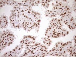 EXOSC1 Monoclonal Antibody (OTI1H9), TrueMAB , OriGene 100 &mu;L | Buy Online | OriGene | Fisher Scientific