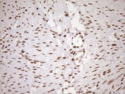 EXOSC1 Monoclonal Antibody (OTI1H9), TrueMAB , OriGene 100 &mu;L | Buy Online | OriGene | Fisher Scientific