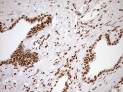 EXOSC1 Monoclonal Antibody (OTI1H9), TrueMAB , OriGene 100 &mu;L | Buy Online | OriGene | Fisher Scientific