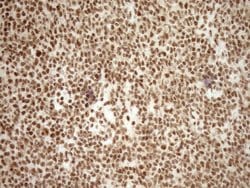 EXOSC1 Monoclonal Antibody (OTI1H9), TrueMAB , OriGene 100 &mu;L | Buy Online | OriGene | Fisher Scientific
