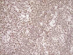 EXOSC1 Monoclonal Antibody (OTI1H9), TrueMAB , OriGene 100 &mu;L | Buy Online | OriGene | Fisher Scientific