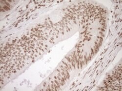 EXOSC1 Monoclonal Antibody (OTI1H9), TrueMAB , OriGene 100 &mu;L | Buy Online | OriGene | Fisher Scientific