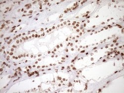 EXOSC1 Monoclonal Antibody (OTI1H9), TrueMAB , OriGene 100 &mu;L | Buy Online | OriGene | Fisher Scientific