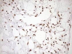 EXOSC1 Monoclonal Antibody (OTI1H9), TrueMAB , OriGene 100 &mu;L | Buy Online | OriGene | Fisher Scientific